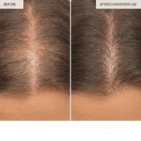 Koyna Hair & Scalp Oil Test - sage & veda