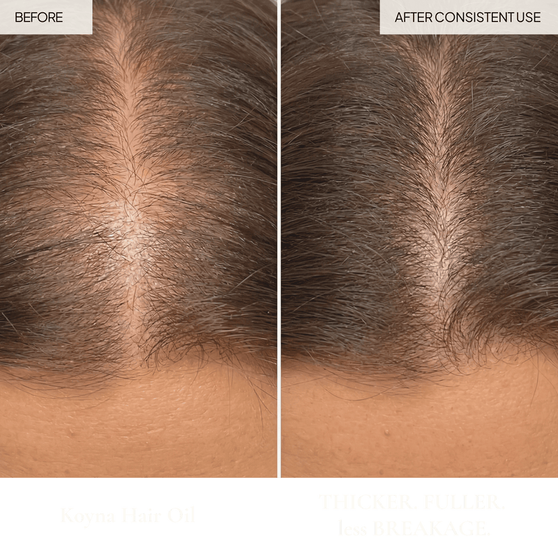 Koyna Hair & Scalp Oil Test - sage & veda